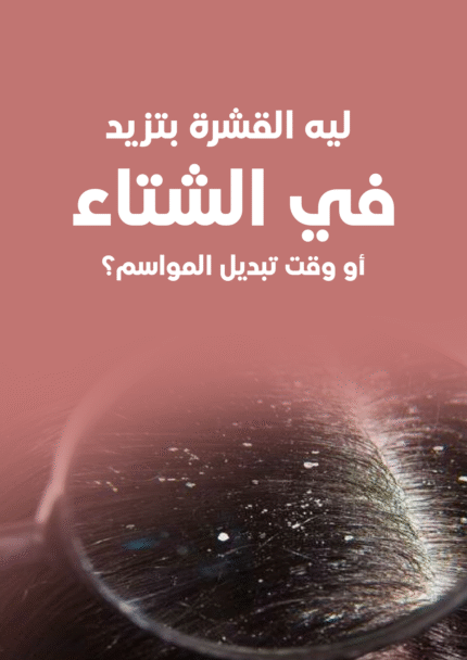 ليه القشرة بتزيد في الشتا أو وقت تبديل المواسم