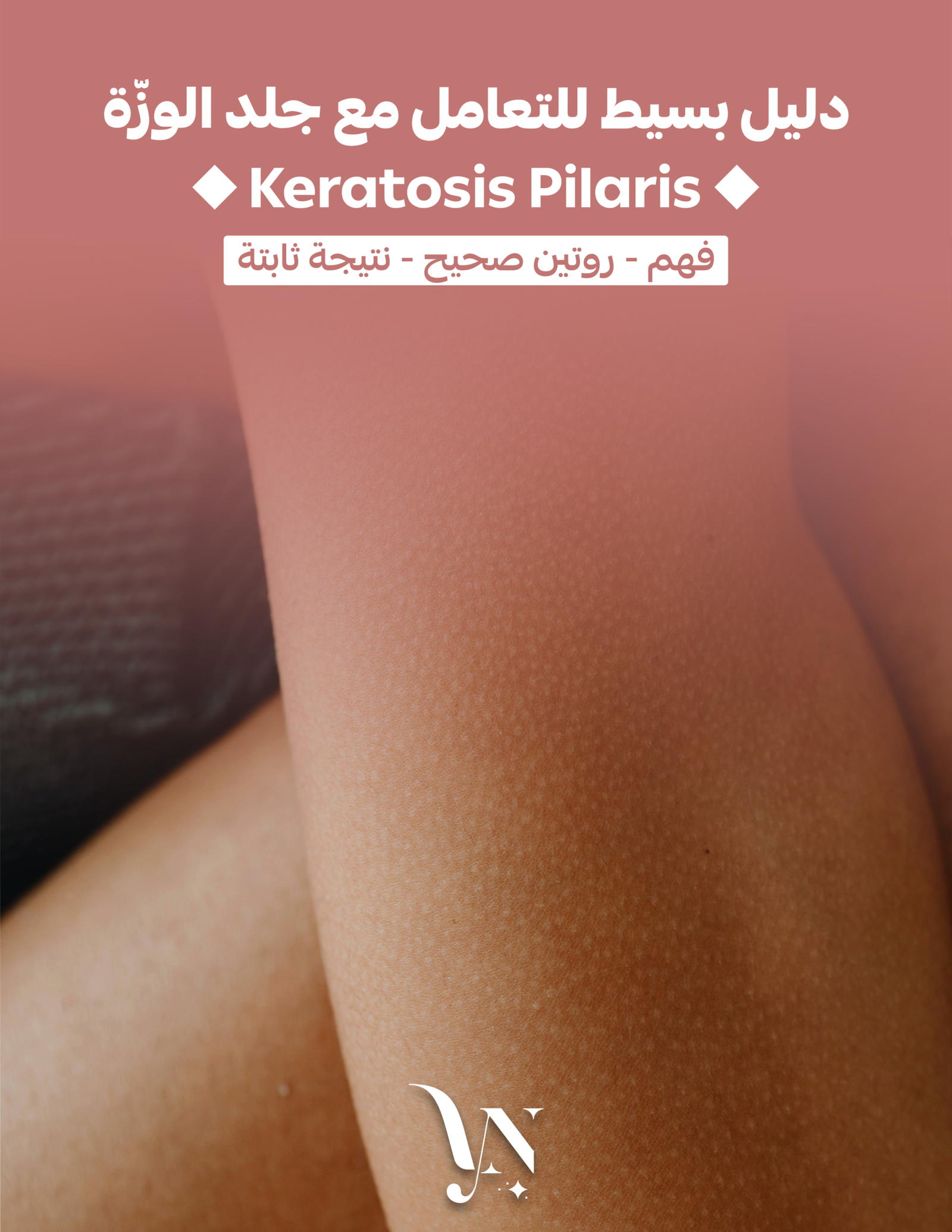 Keratosis Pilaris-1